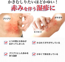 將圖片載入圖庫檢視器 曼秀雷敦 Mediquick Pro 濕疹 蕁麻疹 軟膏 8g